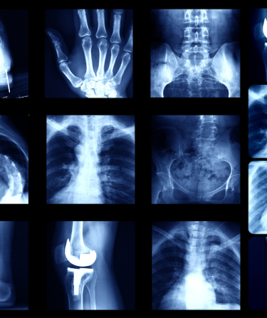 X-rays