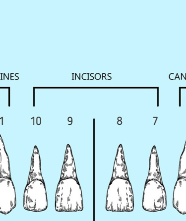 Diagram of upper teeth