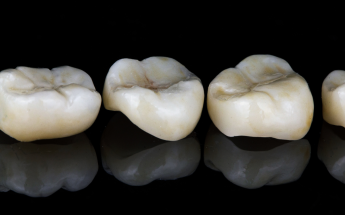 Fixed Prosthodontics crowns